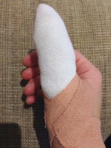 Poorly thumb